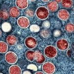 中国提高猴痘预警级别 等同新冠病毒