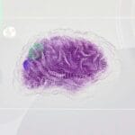 人受伤或者生病后那么痛苦 为什么大脑不能自己屏蔽掉痛觉神经?