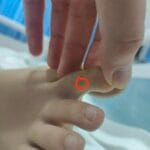 女子在三亚被咬伤身亡，三亚卫健委回应抗蛇毒血清配备问题