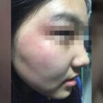 武汉17岁女生与男同学冲突中被打致颅脑损伤，学校：多部门已介入处理